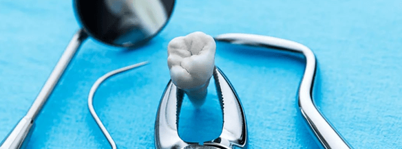 о удалении зуба